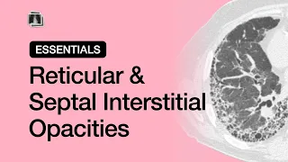 Reticular & Septal Interstitial Opacities | Chest Radiology Essentials