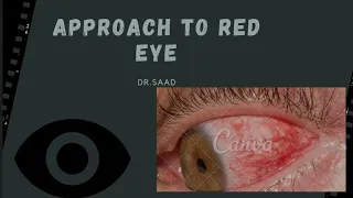 Approach To RED EYE| Differential Diagnosis|Definitive diagnosis