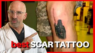 Tattoos + Surgery Scars - Even Better! #Shorts