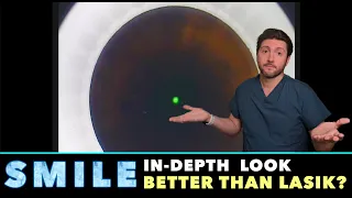 SMILE Surgery | In-Depth Look | Is it better than LASIK or PRK?