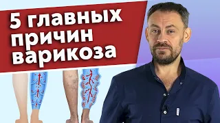 Что такое варикоз? / Основные причины варикозного расширения вен