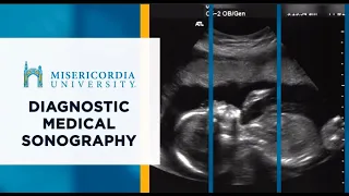 Misericordia University Diagnostic Medical Sonography Program