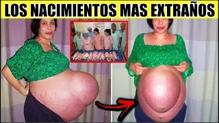 15 Nacimientos Más Extraños del Mundo