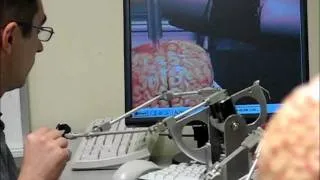 Simulated Haptic Telerobotic Brain Surgery