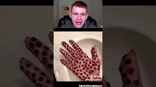 Images That Test Trypophobia 😬
