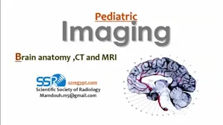 Imaging of normal pediatric brain anatomy (DRE) Prof. Mamdouh Mahfouz