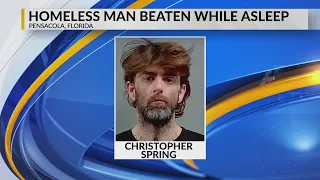 Homeless man beaten while asleep