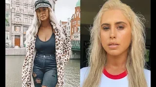 IG Model LEAVES Social Media After Being TR0LLED For "Natural" Look