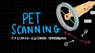 Positron-Electron Tomography (PET Scan) | Medical Physics | A Levels | New Syllabus
