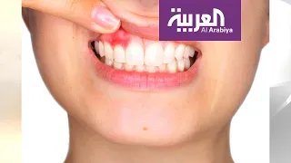 صباح العربية | اللثة السليمة أساس لأسنان قوية