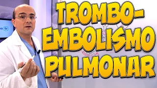 TROMBOEMBOLISMO PULMONAR - Enfermedades #40