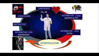 Shock and perfusion in ICU