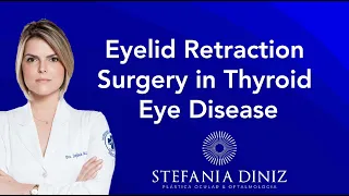 Eyelid Retraction Surgery in Thyroid Eye Disease - Cirurgia de Retração Palpebral em Orb. de Graves