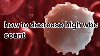 how to decrease high wbc count | how to decrease high white blood cells