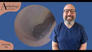 DIFFICULT ANTERIOR RECESS EAR WAX REMOVAL - EP750