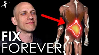 How to Fix Low Back Pain (FOREVER).