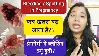 प्रेगनेंसी में ब्लीडिंग आने का कारण | Reasons Of Spotting And Bleeding In Pregnancy |Early Pregnancy