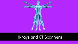 X-rays and CT Scanners - How Do They Work and What are the Problems? - GCSE Physics