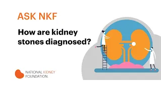 Kidney stone diagnosis, signs, symptoms, and causes | National Kidney Foundation