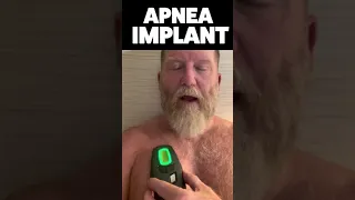 ⚡️Inspire Sleep Apnea Implant Activation By Doug #shorts⚡️