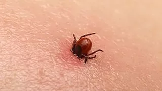 How to remove a tick the easy way. Tick Key Review - Tick Remover review.
