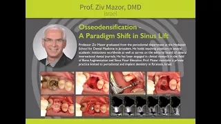 Osseodesification: A Paradigm Shift in Sinus Lift - Professor Ziv Mazor