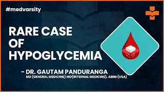 Hypoglycemia: Rare Case Discussion | @MedvarsityOnlineLtd