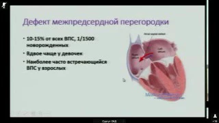 Семинар на тему «Ацианотические пороки, связанные с шунтированием крови слева направо»