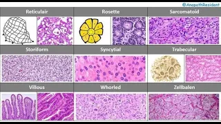 PATTERNS IN PATHOLOGY | HOW TO RECOGNIZE AND REPORT | MUST KNOW FOR BEGINNERS