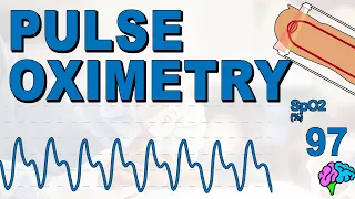 What is Pulse Oximetry?