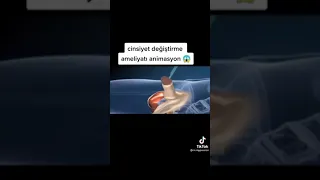 CİNSİYET DEĞİŞİM AMELİYATI