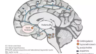 Neuropathology and Treatment of Hypersomnia