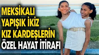 Yapışık Kız Kardeşler Özel Hayatlarını İtiraf Ettiler. Her Soruyu Açıkça Cevapladılar