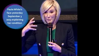 Paula White suffers partial facial paralysis. Shingles?