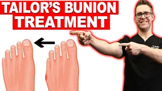 #1 Tailor's Bunion & Bunionette Treatment? [Correctors? Surgery?]