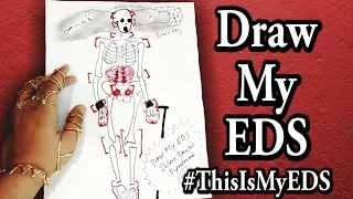 Draw My EDS #ThisIsMyEDS [CC]