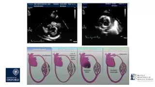 Oxford University surgical lectures: Haemodynamic monitoring