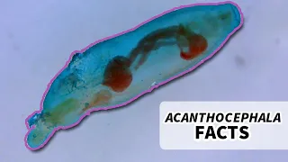 Acanthocephala Facts: the Thorny Headed Worm | Animal Fact Files