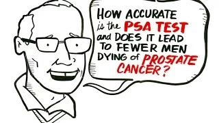 The Prostate Specific Antigen (PSA) Test