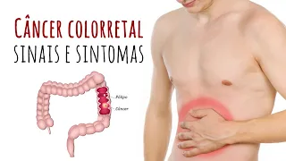 Câncer Colorretal - Sinais e Sintomas