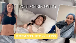 My Breast Lift & Lipo Surgery journey - Post OP Recovery Vlog