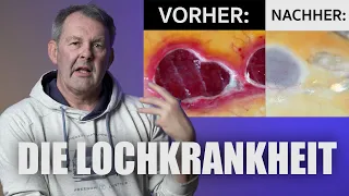 Die Lochkrankheit beim Koi - KOIDOC's PRAXISTIPP