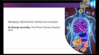 Managing LVAD/driveline infection pre-transplant Dr George Javorsky