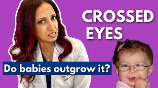 Eye Crossing in Babies: Do They Outgrow It?