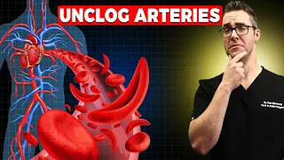 29 WORST Heart & Artery Foods To Avoid [🔄 REVERSE Clogged Arteries!]