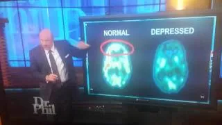 Normal Brain VS Depressed Brain