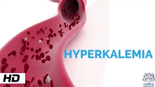 HYPERKALEMIA, Causes, Signs and Symptoms, Diagnosis and Treatment.