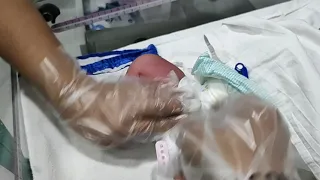 How to change nappy of a newborn (girl).