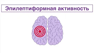 ЭЭГ-8. Эпилептиформная активность. Интериктальная активность.