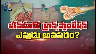 Bone Marrow Transplantation Overview | Sukhibhava | 15th February 2022 | ETV Andhra Pradesh